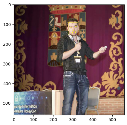 Detection result